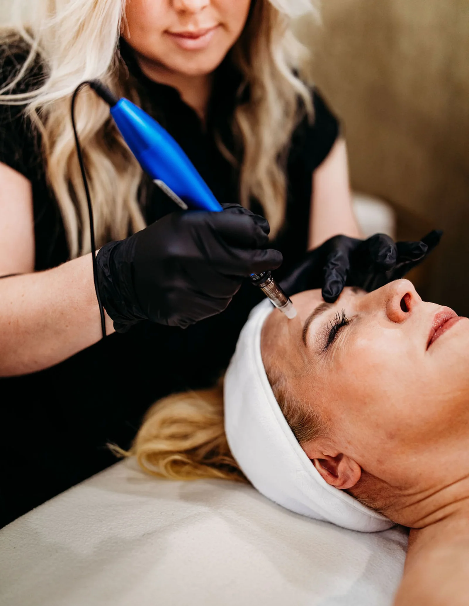 Lasers and microneedling at Crafted Aesthetics